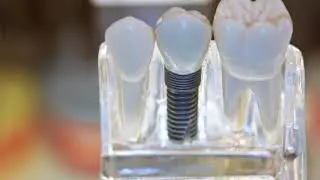 El Camino Dental Arts - Implant Dentist