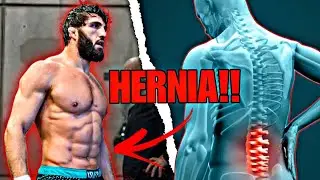LA VERDAD DE SU RETIRO VS MAKHACHEV!! ARMAN CONFIESA TENER UNA HÉRNIA