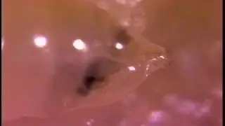 Fruit Fly Larva: Just Plain Beautiful