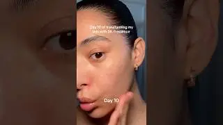 Transforming my skin with SK-II essence #essence #japaneseskincare #skincaretransformation