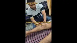 Sciatica pain relief to acupuncture needles therapy 29/3/2205 live stream
