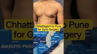 Chhattisgarh to Pune for Gynecomastia Surgery | Patient Experience & Recovery! | Dr DC, India