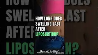How Long Does Swelling Last After Liposuction? | Recovery Timeline & Results #liposuction #shorts