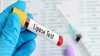 Lipaz (LPS) nedir? Lipaz d&uuml;ş&uuml;kl&uuml;ğ&uuml; ve y&uuml;kseliği ne anlama gelir?