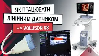 Лінійний датчик 9L4 RS до GE Voluson S8 - навчання