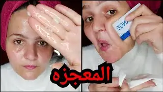الجلسه ام بلاش بتعمل معجزات    عصاره خبره ١٥ سنه ف التجميل ف الزيت ده ✌