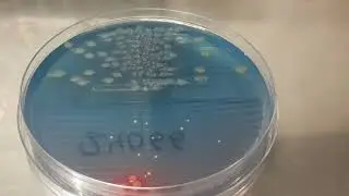 Colony characteristics of Pseudomonas aeruginosa on CLED Agar of Urine Culture