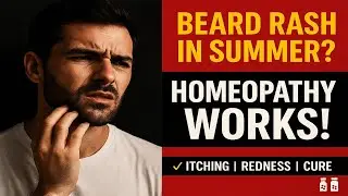 Homeopathy Treatment for Beard Rash in Summer | गर्मी में दाढ़ी में रेश | कारण, लक्षण और इलाज