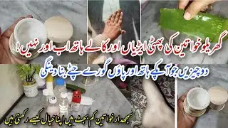 Best Hand & Foot Remedy for Cracked Heels✨ Daily Routine for Housewives Powerful Foot Care Remedy