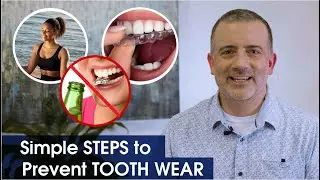 Tooth Wear 101 w/ Dr. O: What It Is + How to Prevent It | Austin Dental | Dentists in Austin, TX