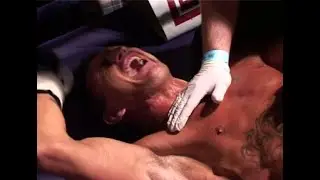 Boxer Dislocates Knee in Fight and Wants to Fight On!