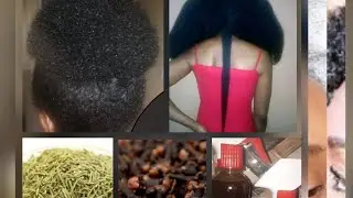 The Right way to use Rosemary leaves and Cloves spray for extreme hair grow