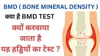 BMD-Bone Mineral Density Test क्यों करवाया जाता है ?