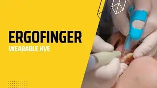 ErgoFinger HVE Aerosol Control System - HVE Tip - Wearable High Volume Suction