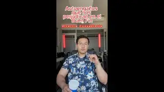 Autoenga&ntilde;os que nos perjudican en el Buen Fin