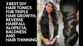3 Ways To Use CASTOR OIL For EXTREME HAIR GROWTH/ 7 Days Castor oil Challenge for 3
