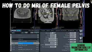 MRI of Female Pelvis Planning and Filming-Live Console Tutorial | SIEMENS Magnetom Aera-1.5T |
