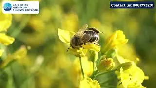 Allergy ka Permanent Ilaaj | Immunotherapy Patient Testimonial | E.N.T & Vertigo Allergy Clinic