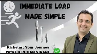 Immediate Load Implants: Your Beginner's Kickstart Guide