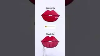 lip filler technique #lipfiller #lipfillertechnique #fillerinjection #lipsfiller