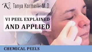 VI Peel Explained and Applied