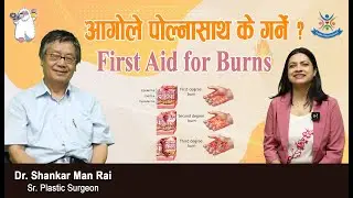 आगोले पोल्नासाथ के गर्ने ?First Aid for Burns(Dr. Shankar Man Rai Sr. Plastic Surgeon)