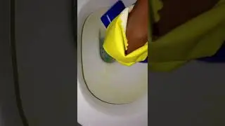 Transforming Dirty to Dazzling ✨😲: Unveiling the Sparkling Toilet 🚽 Makeover 💯✨✨