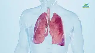 Tuberculosis Treatment at Bansal Hospital | Dr. Santosh Agrawal