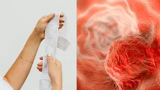 The Hidden Danger in Your Receipts &ndash; How BPA is Affecting Your Health!