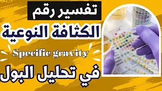 14_What is the specific gravity of urine and how to interpret cases of high and low levels??!!!