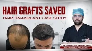 Hair Transplant In Grade VI Baldness? Your Hair Grafts Can Be Preserved |  Dr. Prakash Khute MD