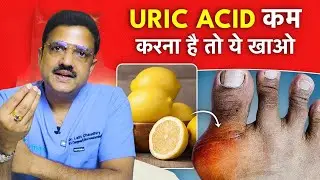 You will have to do this work daily, URIC ACID will never increase #uric_acid #uricacid #uricacid...