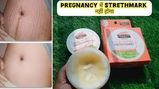 Pregnancy में strethmark को करे bye bye| palmer cocoa butter formula| tummy butter | stretch mark |