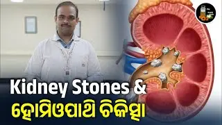 Homeopathic Medicine For Kidney Stones With Patients Review |Homeopathie The Health Guide 