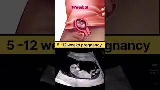 Baby Development 5_12 weeks pregnancy #ultrasound #baby #pregnancy #pregnant #viral #shorts