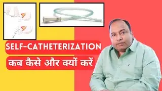 Clean Intermittent Catheterisation (CIC) : Self-Catheterization कब कैसे और क्यों करें