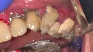 How can someone go about their day with teeth like this?