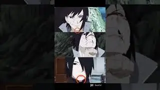 Naruto becomes a doctor|Naruto fixing jaws😂😂#shorts #trending