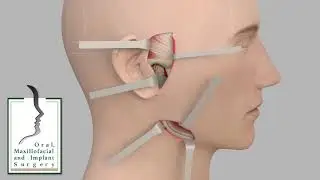 TMJ Surgery by Kalant, Pink & Associates in Naperville IL