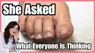 She Thought Her Pedicure Ruined Her Toenails    The Truth Surprised Her