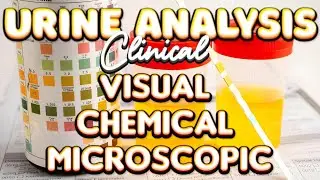 Urinalysis: Visual , Chemical & Microscopic analysis &bull; Practical Physiology