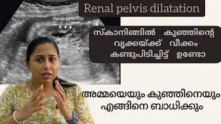 Renal pelvic dilatation in pregnancy Malayalam #drchithra #pregnancycare