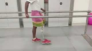 | The News Mill | Affordable Prosthetic Leg by IIT Guwahati  #IITGuwahati #ProstheticLeg