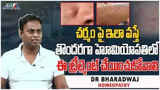 చర్మం పై ఇలా వస్తే | Dr Bharadwaj | Skin pimples | Homeopathy | Health Tips in Telugu | Tree Media