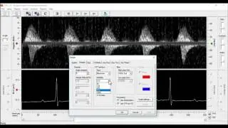 Analysing PWV using the DSPW software (Indus Instruments)