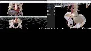 3DVerse AFC2019