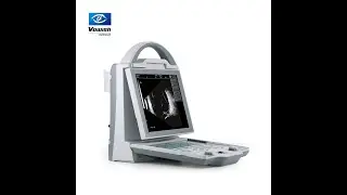 Ophthalmic AB scan ODU5 operation video PART1