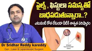 పైల్స్ కు ట్రీట్మెంట్ || Best Treatment for Piles and Fissure in Telugu || Treatment Range Hospitals