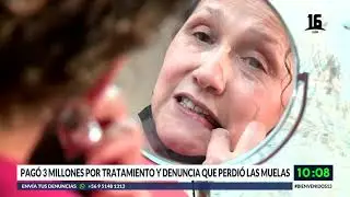 Mujer denuncia que negligencia dental le hizo perder sus muelas. Bienvenidos, Canal 13.
