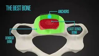 Nexus Spine Stable-C&trade;
